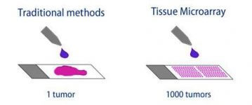 傳統病理切片 vs 高通量 TMA 技術