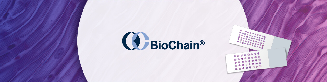 BioChain FFPE & TMA 平台：加速轉譯醫學與生物標記研究的關鍵資源