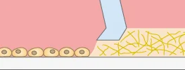 Cells outside the micro-Insert