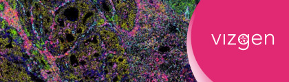 空間轉錄體學線上講座 - How can clinicians use spatial transcriptomics data to interpret the complexity of tumor microenvironment?