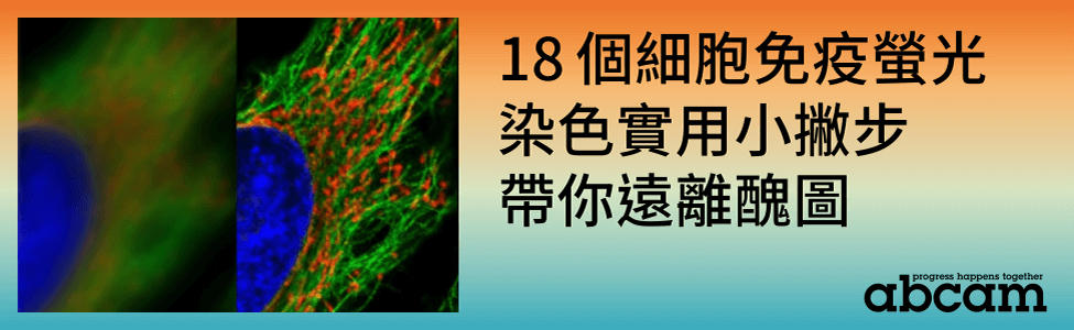 細胞免疫螢光染色沒有訊號或背景值過高？18 個實用小撇步帶你遠離醜圖