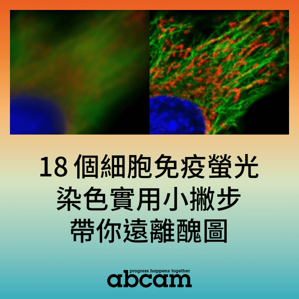 細胞免疫螢光染色沒有訊號或背景值過高？18 個實用小撇步帶你遠離醜圖